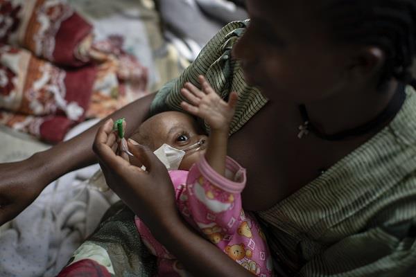 Ethiopian malnourished baby