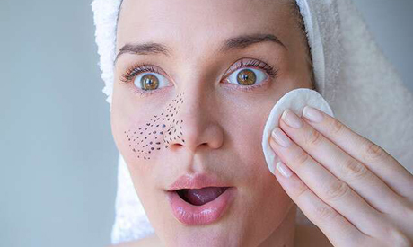 Home remedies for blackheads 