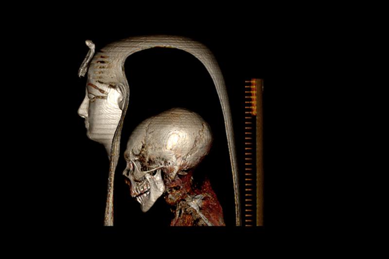 Screenshots of the x-rays carried out on the mummy