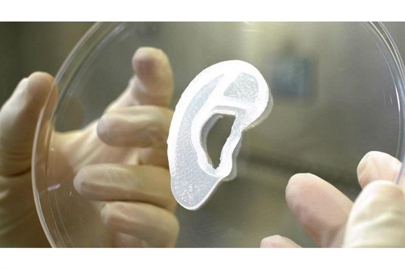  3D bioimplant of an ear lobe -AFP