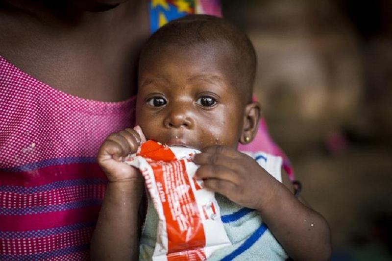 A girl suffer from malnutrition in Mali